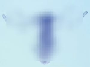 071017-Opsin-Hydra-02